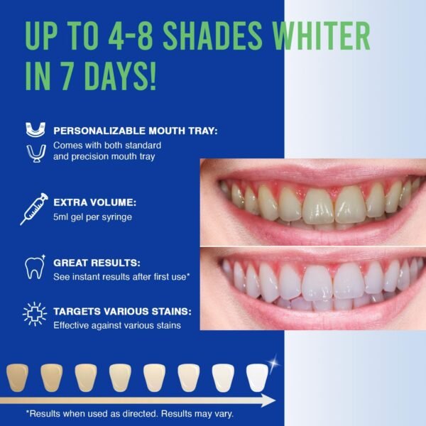 VieBeauti Teeth Whitening Kit - 5X LED Light Tooth Whitener with 35% Carbamide Peroxide, Mouth Trays, Remineralizing Gel and Tray Case - Built-in 10 Minute Timer Restores Your White Smile Mint - Image 2